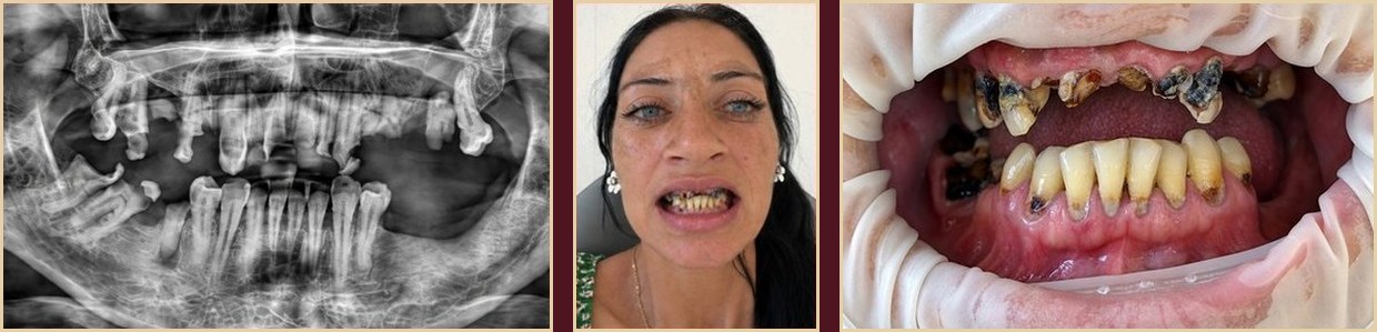 S.M., 33-year-old female