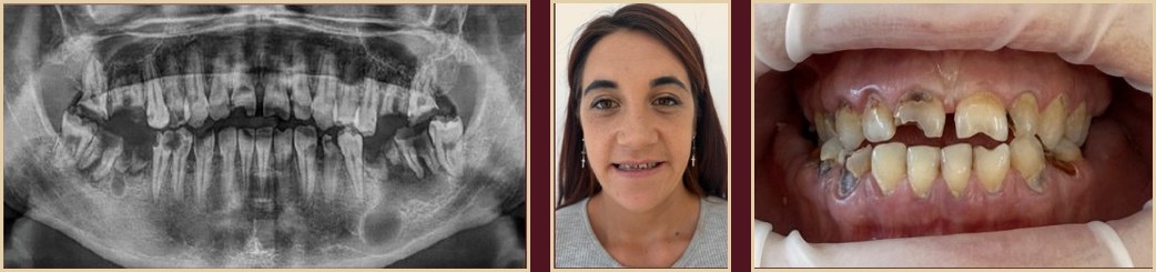 T.A., 22-year-old female