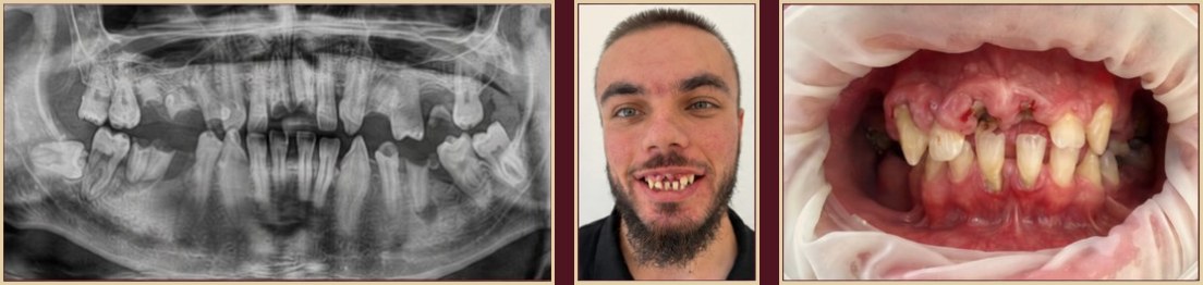 T.R., 23-year-old male