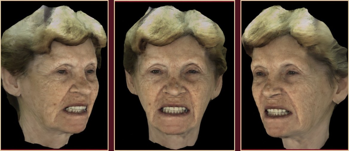 3D face scan — RayFace