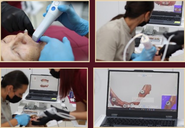Intraoral scanning — Medit i900