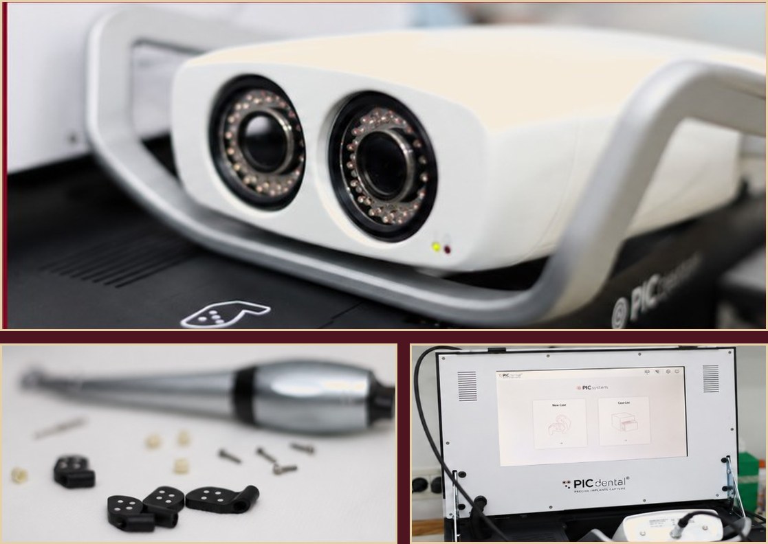 Photogrammetry — PiC dental