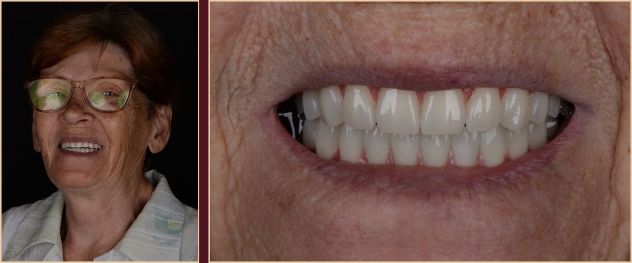 A smile worn with confidence