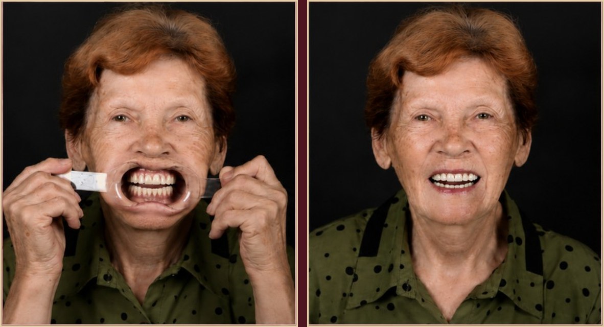 Temporary provisionals