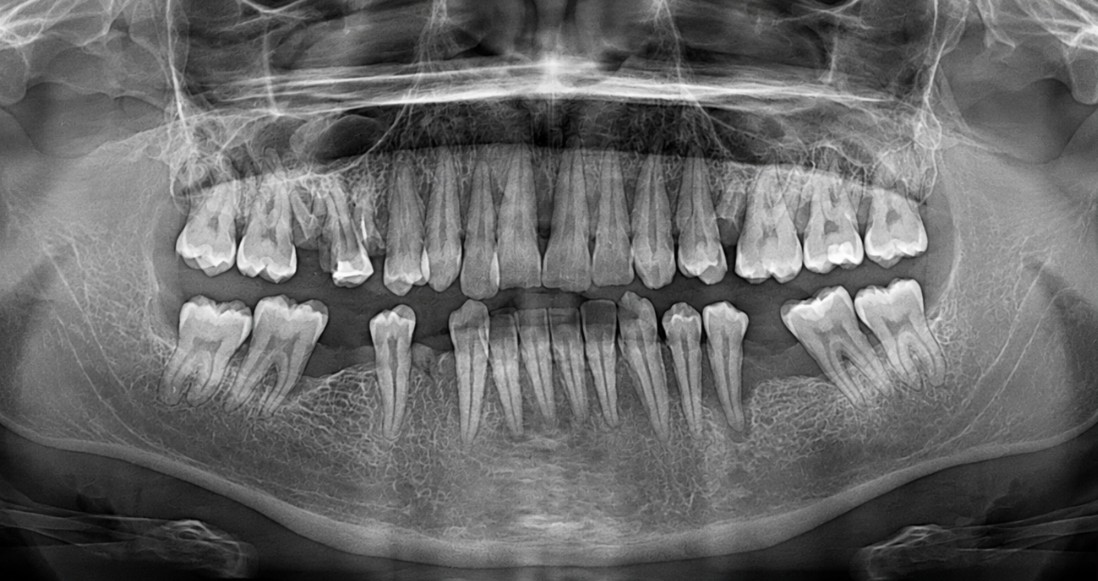Dental radiograph
