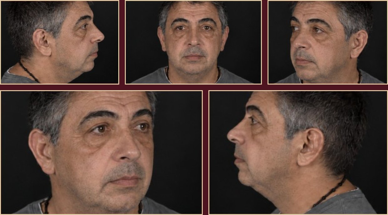 Photographic documentation — facial
