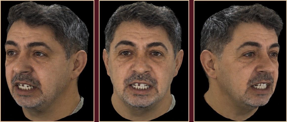 3D face scan — RayFace