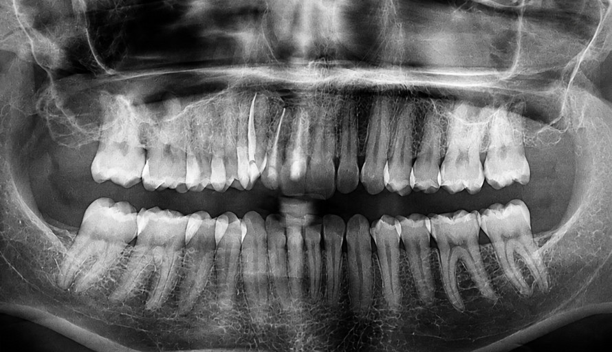 Dental radiograph